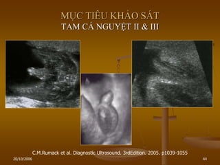20/10/2006 44
MỤC TIÊU KHẢO SÁT
TAM CÁ NGUYỆT II & III
C.M.Rumack et al. Diagnostic Ultrasound. 3rdEdition. 2005. p1039-1055
 
