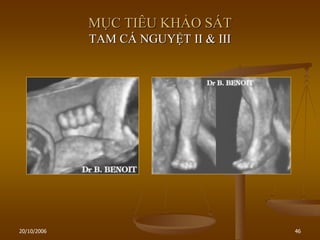 20/10/2006 46
MỤC TIÊU KHẢO SÁT
TAM CÁ NGUYỆT II & III
 