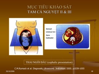 20/10/2006 48
MỤC TIÊU KHẢO SÁT
TAM CÁ NGUYỆT II & III
C.M.Rumack et al. Diagnostic Ultrasound. 3rdEdition. 2005. p1039-1055
THAI NGÔI ĐẦU (cephalic presentation)
 