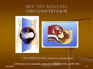 20/10/2006 50
MỤC TIÊU KHẢO SÁT
TAM CÁ NGUYỆT II & III
C.M.Rumack et al. Diagnostic Ultrasound. 3rdEdition. 2005. p1039-1055
THAI NGÔI NGANG ( transverse presentation)
 
