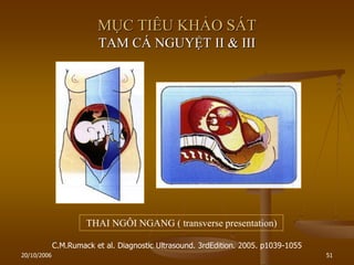 20/10/2006 51
MỤC TIÊU KHẢO SÁT
TAM CÁ NGUYỆT II & III
C.M.Rumack et al. Diagnostic Ultrasound. 3rdEdition. 2005. p1039-1055
THAI NGÔI NGANG ( transverse presentation)
 
