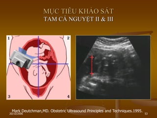 20/10/2006 53
MỤC TIÊU KHẢO SÁT
TAM CÁ NGUYỆT II & III
Mark Deutchman,MD. Obstetric Ultrasound Principles and Techniques.1995.
 