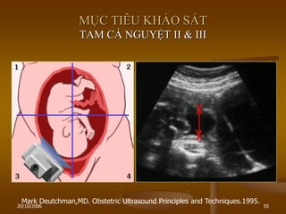 20/10/2006 55
MỤC TIÊU KHẢO SÁT
TAM CÁ NGUYỆT II & III
Mark Deutchman,MD. Obstetric Ultrasound Principles and Techniques.1995.
 