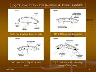 20/10/2006 58
ĐỘ TRƢỞNG THÀNH CỦA BÁNH NHAU THEO GRANNUM
Độ 0: Hồi âm đồng dạng, bờ nhẵn Độ 1: Hồi âm thô, bờ gồ ghề
Độ 2: Vôi hóa ở đáy và các múi
nhau
Độ 3: Vôi hóa nhiều và những
vùng hồi âm trống
 