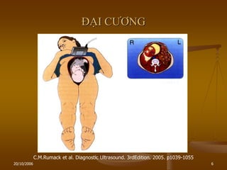 20/10/2006 6
ĐẠI CƢƠNG
C.M.Rumack et al. Diagnostic Ultrasound. 3rdEdition. 2005. p1039-1055
 