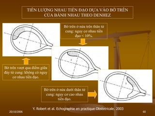 20/10/2006 60
Y. Robert et al. Echographie en practique Obstetricale. 2003
TIÊN LƢỢNG NHAU TIỀN ĐẠO DỰA VÀO BỜ TRÊN
CỦA BÁNH NHAU THEO DENHEZ
Bờ trên vƣợt qua điểm giữa
đáy tử cung: không có nguy
cơ nhau tiền đạo.
Bờ trên ở nửa trên thân tử
cung: nguy cơ nhau tiền
đạo < 10%.
Bờ trên ở nửa dƣới thân tử
cung: nguy cơ cao nhau
tiền đạo.
 