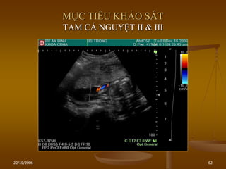 20/10/2006 62
MỤC TIÊU KHẢO SÁT
TAM CÁ NGUYỆT II & III
 