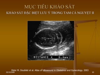 20/10/2006 65
MỤC TIÊU KHẢO SÁT
KHẢO SÁT ĐẶC BIỆT LƢU Ý TRONG TAM CÁ NGUYỆT II
Peter M. Doubilet et al. Atlas of Ultrasound in Obstetrics and Gynecology. 2003
 
