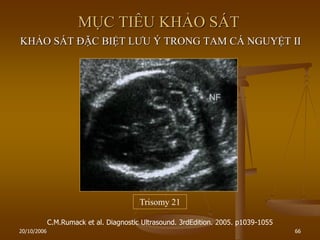 20/10/2006 66
MỤC TIÊU KHẢO SÁT
KHẢO SÁT ĐẶC BIỆT LƢU Ý TRONG TAM CÁ NGUYỆT II
C.M.Rumack et al. Diagnostic Ultrasound. 3rdEdition. 2005. p1039-1055
Trisomy 21
 