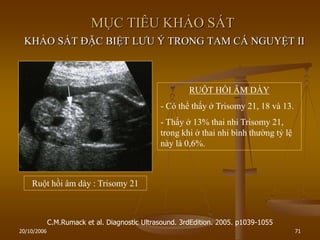 20/10/2006 71
MỤC TIÊU KHẢO SÁT
KHẢO SÁT ĐẶC BIỆT LƢU Ý TRONG TAM CÁ NGUYỆT II
C.M.Rumack et al. Diagnostic Ultrasound. 3rdEdition. 2005. p1039-1055
RUỘT HỒI ÂM DÀY
- Có thể thấy ở Trisomy 21, 18 và 13.
- Thấy ở 13% thai nhi Trisomy 21,
trong khi ở thai nhi bình thƣờng tỷ lệ
này là 0,6%.
Ruột hồi âm dày : Trisomy 21
 