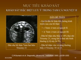 20/10/2006 72
MỤC TIÊU KHẢO SÁT
KHẢO SÁT ĐẶC BIỆT LƢU Ý TRONG TAM CÁ NGUYỆT II
C.M.Rumack et al. Diagnostic Ultrasound. 3rdEdition. 2005. p1039-1055
DÃN BỂ THẬN
- Gọi là dãn bể thận khi đƣờng kính
trƣớc-sau của bể thận:
+ ≥ 5mm: ở tam cá nguyệt II.
+ ≥ 7mm: ở tam cá nguyệt III.
- Dãn bể thận nhẹ thấy ở 18% thai nhi
Trisomy 21, trong khi ở thai nhi bình
thƣờng tỷ lệ này là 3%.
- Dãn bể thận vừa và nặng thƣờng
thấy ở Trisomy 18 và 13.
Dãn nhẹ bể thận 7mm hai bên:
Trisomy 21
 