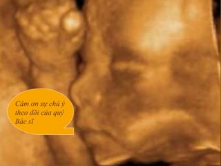 20/10/2006 75
Cám ơn sự chú ý
theo dõi của quý
Bác sĩ
 