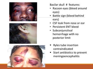 Basilar skull # features:
• Racoon eyes (bleed around
eyes)
• Battle sign (bleed behind
ears)
• CSF leak from nose or ear
• Persistent ENT bleed
• Subconjunctival
hemorrhage with no
posterior limit
 Ryles tube insertion
contraindicated
 Start antibiotics to prevent
meningoencephalitis
 
