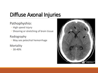 Diffuse Axonal Injuries
Pathophyshio:
◦ High speed injury
◦ Shearing or stretching of brain tissue
Radiography
◦ May see petechial hemorrhage
Mortality
◦ 30-40%
 