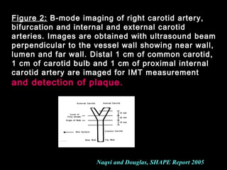 Figure 2: B-mode imaging of right carotid artery,
bifurcation and internal and external carotid
arteries. Images are obtained with ultrasound beam
perpendicular to the vessel wall showing near wall,
lumen and far wall. Distal 1 cm of common carotid,
1 cm of carotid bulb and 1 cm of proximal internal
carotid artery are imaged for IMT measurement
and detection of plaque.and detection of plaque.
Naqvi and Douglas, SHAPE Report 2005
 