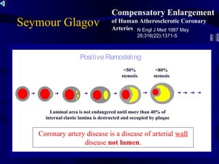 Seymour Glagov
Compensatory Enlargement
of Human Atherosclerotic Coronary
Arteries N Engl J Med 1987 May
28;316(22):1371-5
<50%
stenosis
Luminal area is not endangered until more than 40% of
internal elastic lamina is destructed and occupied by plaque
Coronary artery disease is a disease of arterial wall
disease not lumen.
PositiveRemodeling
<80%
stenosis
 