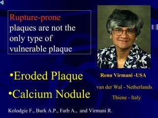 •Eroded Plaque
Rupture-prone
plaques are not the
only type of
vulnerable plaque
•Calcium Nodule
van der Wal - Netherlands
Renu Virmani -USA
Thiene - Italy
Kolodgie F., Burk A.P., Farb A., and Virmani R.
 