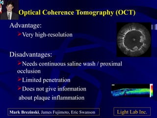 Optical Coherence Tomography (OCT)
Advantage:
Very high-resolution
Disadvantages:
Needs continuous saline wash / proximal
occlusion
Limited penetration
Does not give information
about plaque inflammation
Light Lab Inc.Mark Brezinski, James Fujimoto, Eric Swanson
 