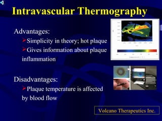 Intravascular Thermography
Advantages:
Simplicity in theory; hot plaque
Gives information about plaque
inflammation
Disadvantages:
Plaque temperature is affected
by blood flow
Volcano Therapeutics Inc.
 