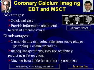 Coronary Calcium Imaging
EBT and MSCT
Advantages:
Quick and easy
Provide information about total
burden of atherosclerosis
Disadvantages:
Cannot distinguish vulnerable from stable plaque
(poor plaque characterization)
Inadequate specificity, may not accurately
predict near future event
May not be suitable for monitoring treatment
Calcium Score
Imatron Inc.Rumberger, Aard, Raggi, and others
 