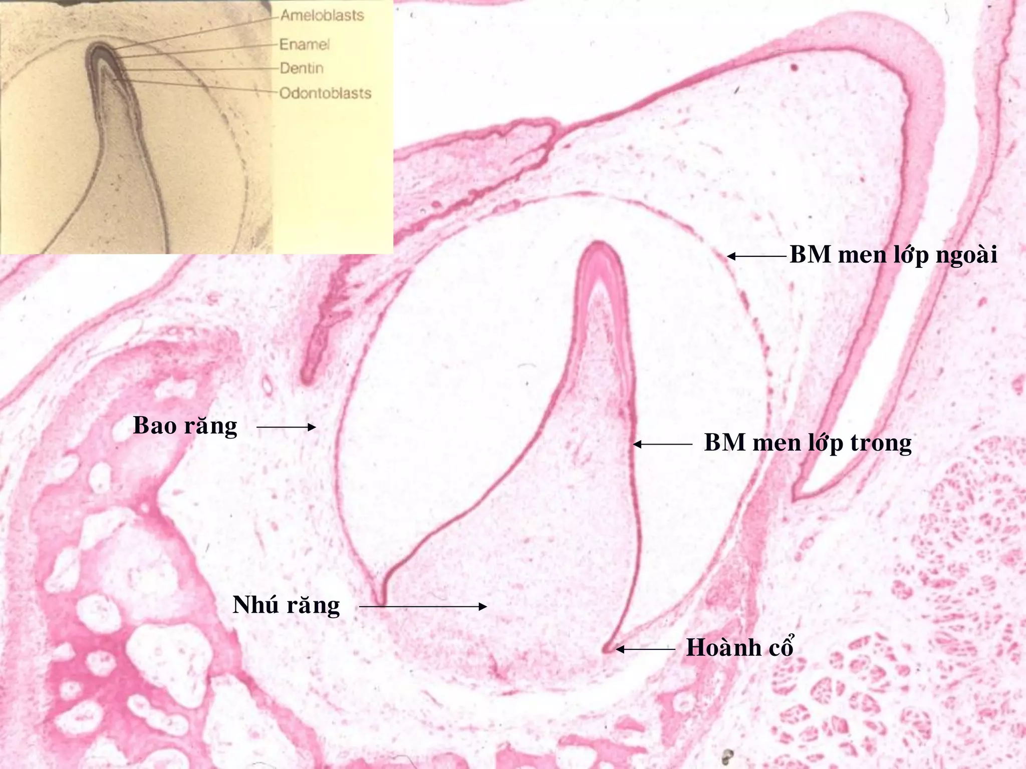 BM men lôùp ngoaøiBM men lôùp ngoaøi
BM men lôùp trong
Hoaønh coå
Bao raêng
Nhuù raêng
 