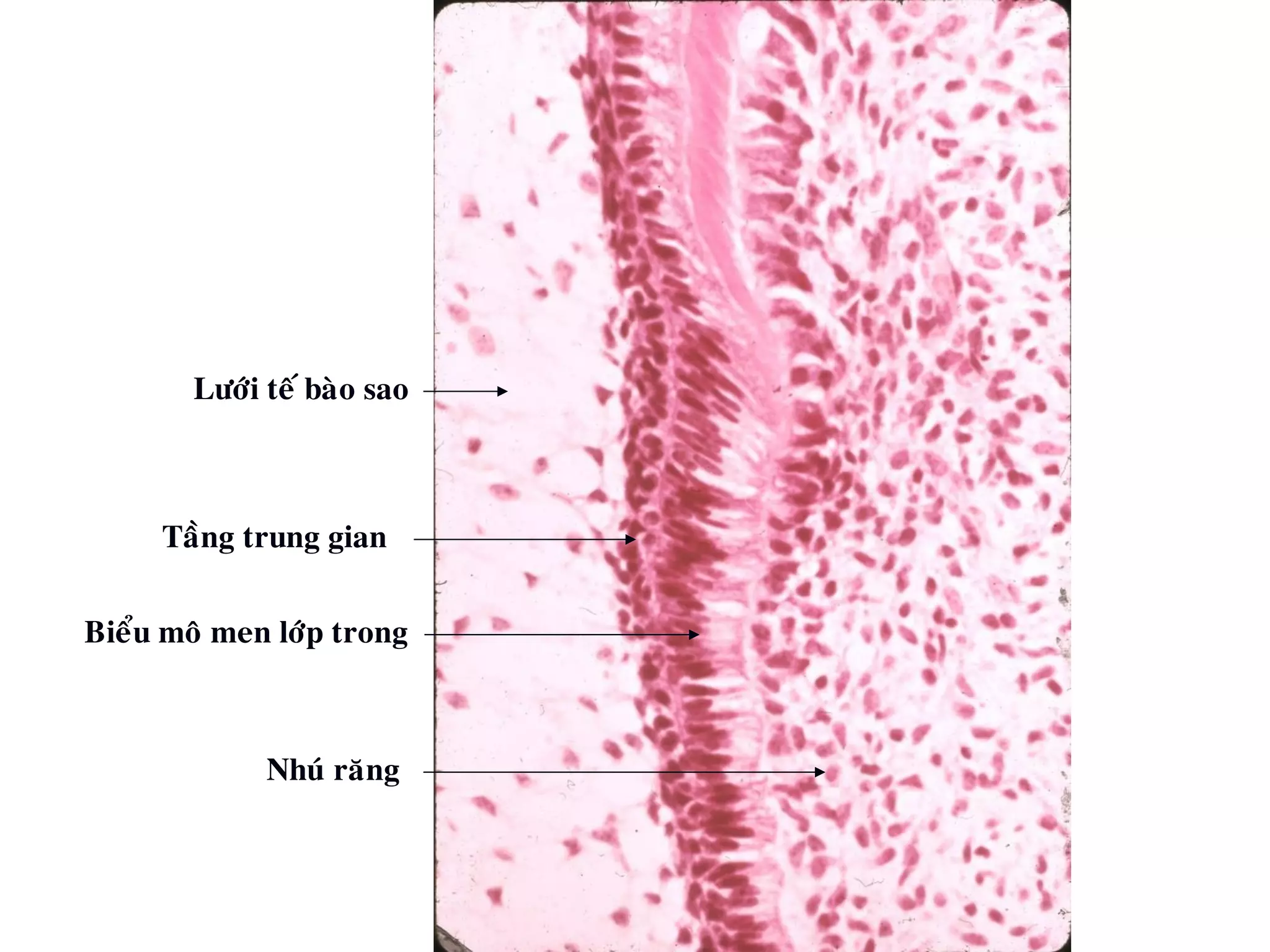 Löôùi teá baøo sao
Taàng trung gian
Bieåu moâ men lôùp trong
Nhuù raêng
 