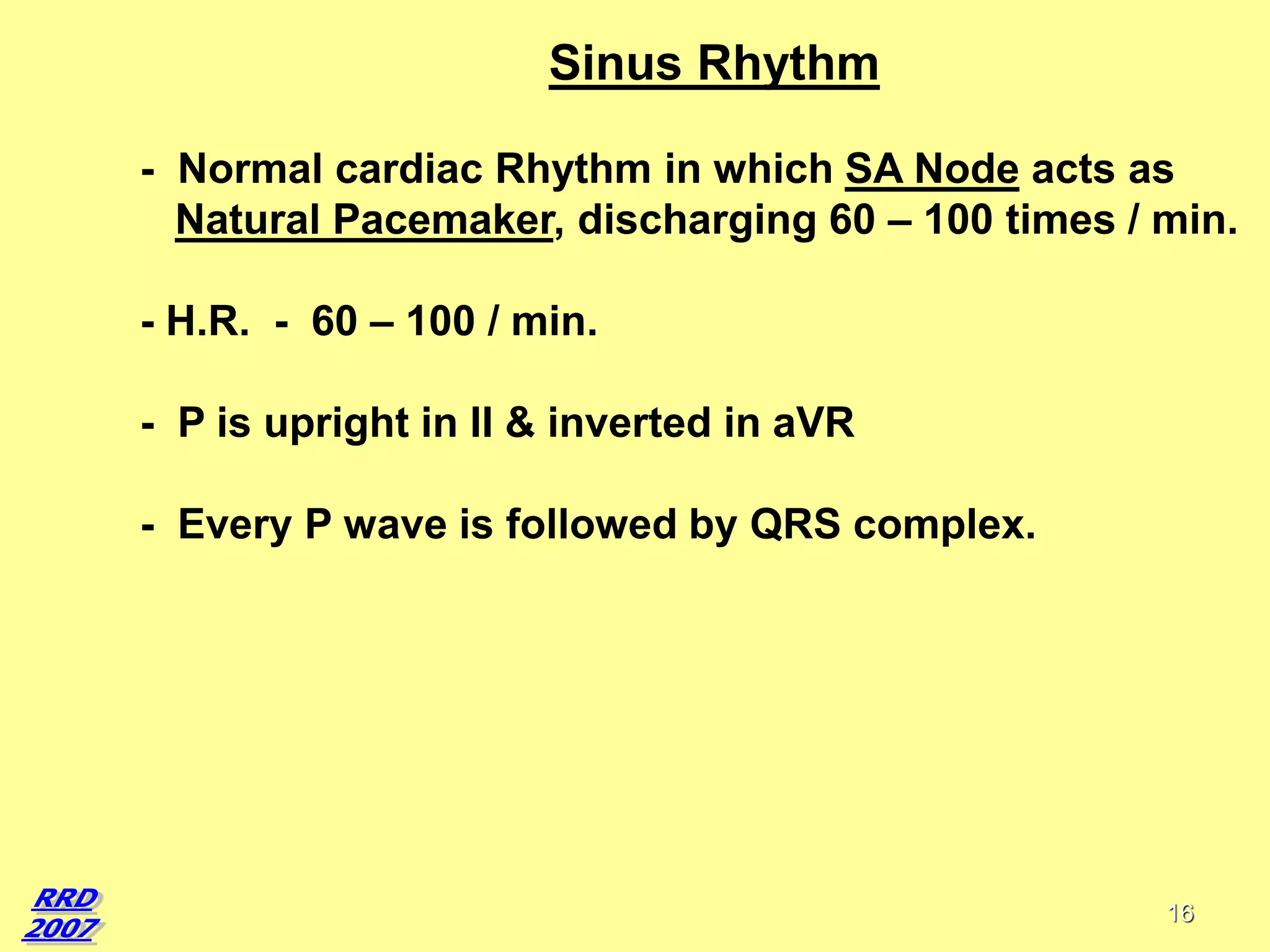 Sinus Rhythm
- Normal cardiac Rhythm in which SA Node acts as
Natural Pacemaker, discharging 60 – 100 times / min.
- H.R. - 60 – 100 / min.

- P is upright in II & inverted in aVR
- Every P wave is followed by QRS complex.

16

 