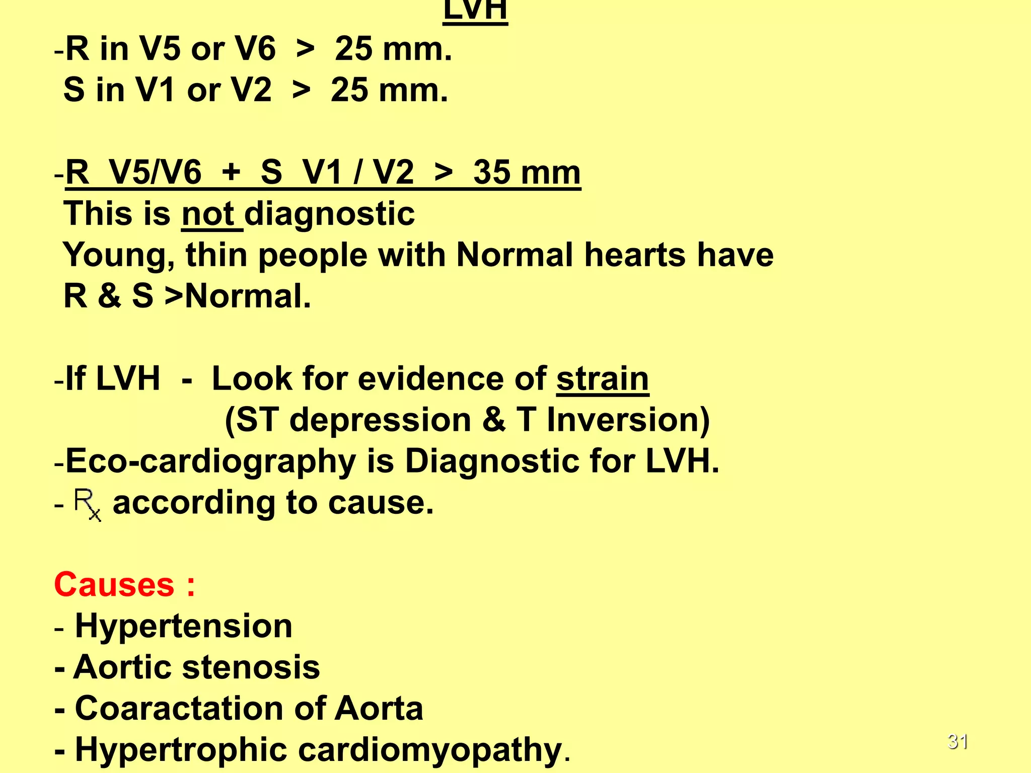 LVH
-R in V5 or V6 > 25 mm.
S in V1 or V2 > 25 mm.
-R V5/V6 + S V1 / V2 > 35 mm
This is not diagnostic
Young, thin people with Normal hearts have
R & S >Normal.
-If LVH - Look for evidence of strain
(ST depression & T Inversion)
-Eco-cardiography is Diagnostic for LVH.
- according to cause.
Causes :
- Hypertension
- Aortic stenosis
- Coaractation of Aorta
- Hypertrophic cardiomyopathy.

31

 