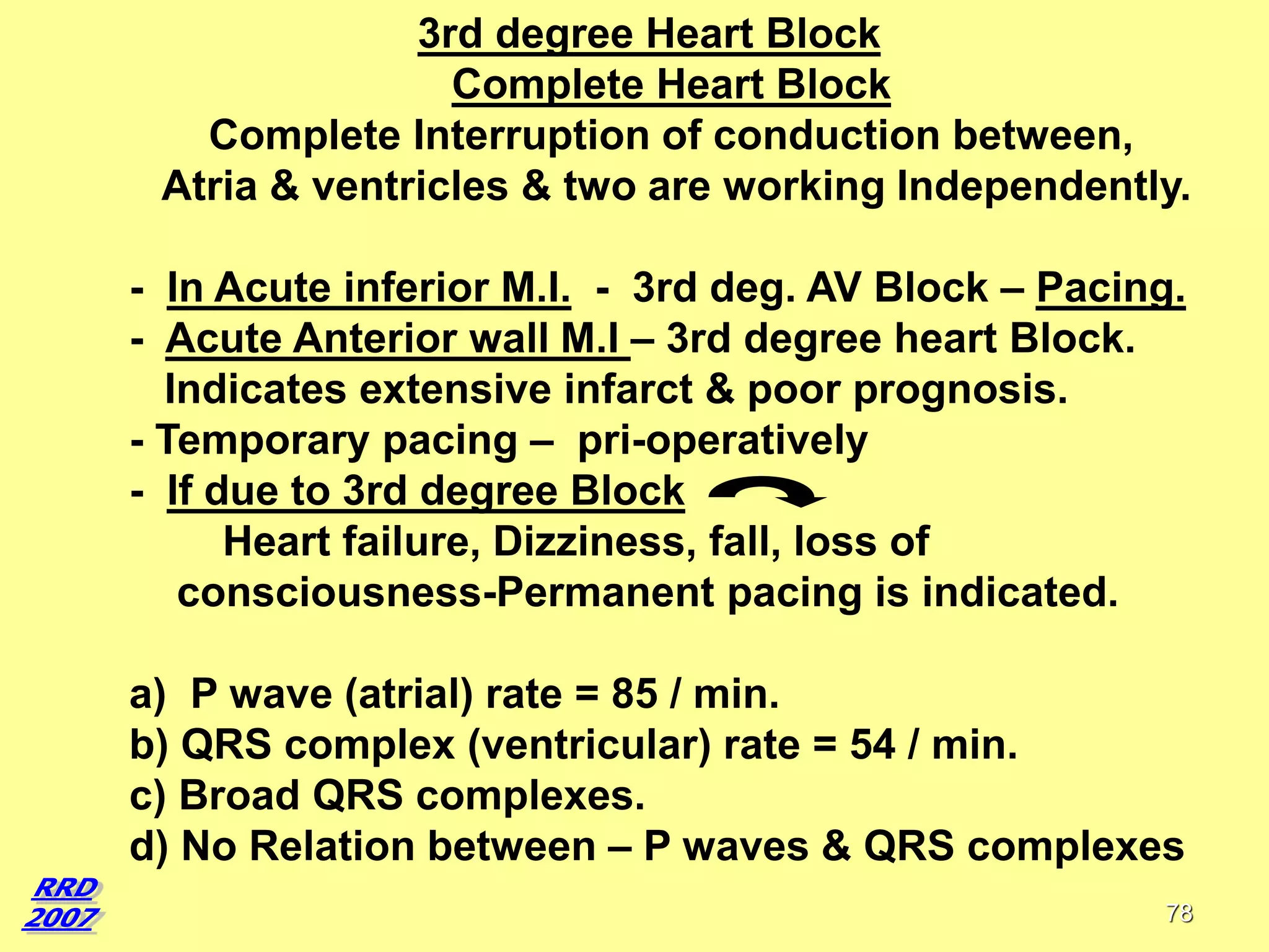 3rd degree Heart Block
Complete Heart Block
Complete Interruption of conduction between,
Atria & ventricles & two are working Independently.

- In Acute inferior M.I. - 3rd deg. AV Block – Pacing.
- Acute Anterior wall M.I – 3rd degree heart Block.
Indicates extensive infarct & poor prognosis.
- Temporary pacing – pri-operatively
- If due to 3rd degree Block
Heart failure, Dizziness, fall, loss of
consciousness-Permanent pacing is indicated.
a) P wave (atrial) rate = 85 / min.
b) QRS complex (ventricular) rate = 54 / min.
c) Broad QRS complexes.
d) No Relation between – P waves & QRS complexes
78

 