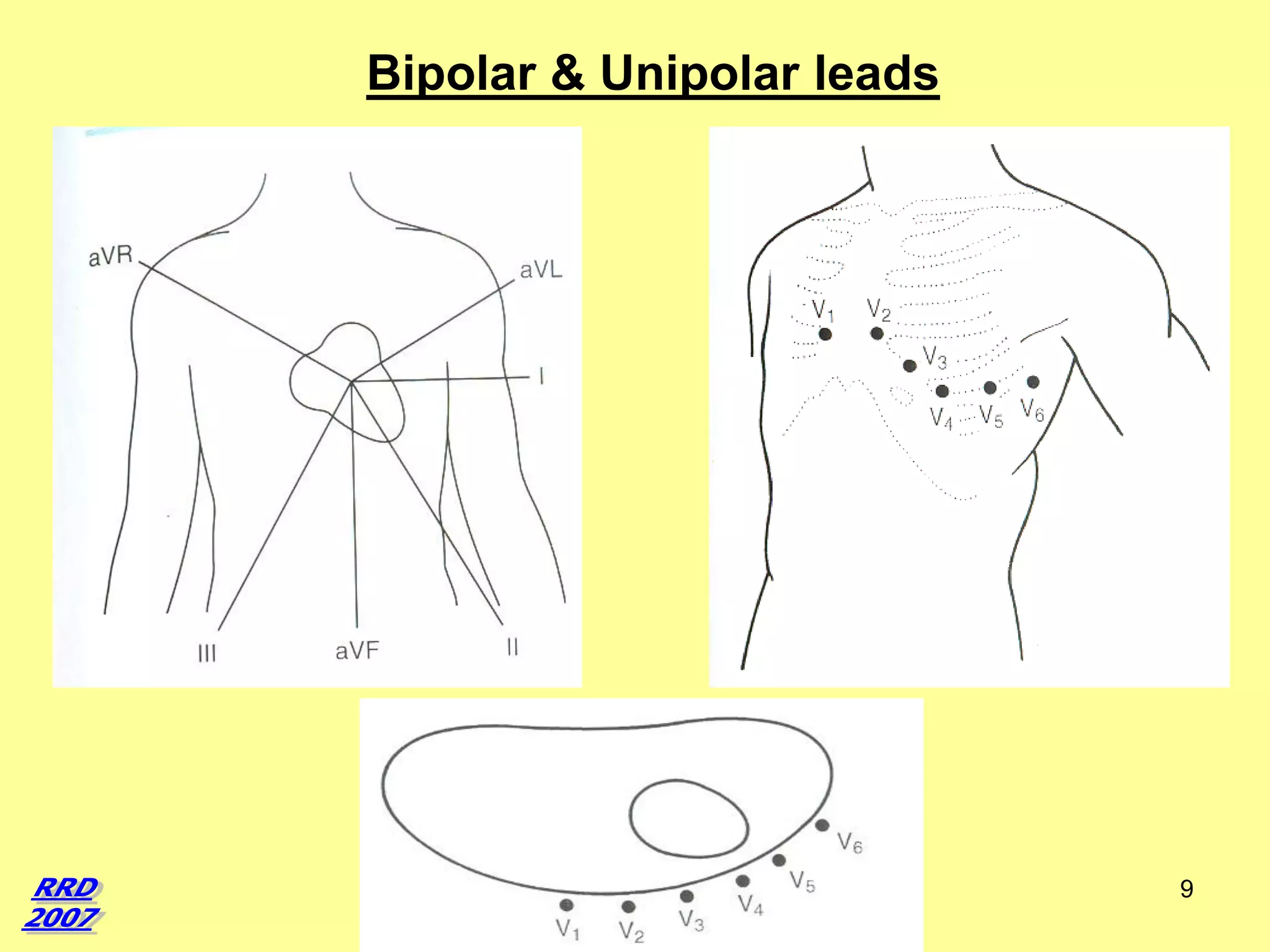 Bipolar & Unipolar leads

9

 