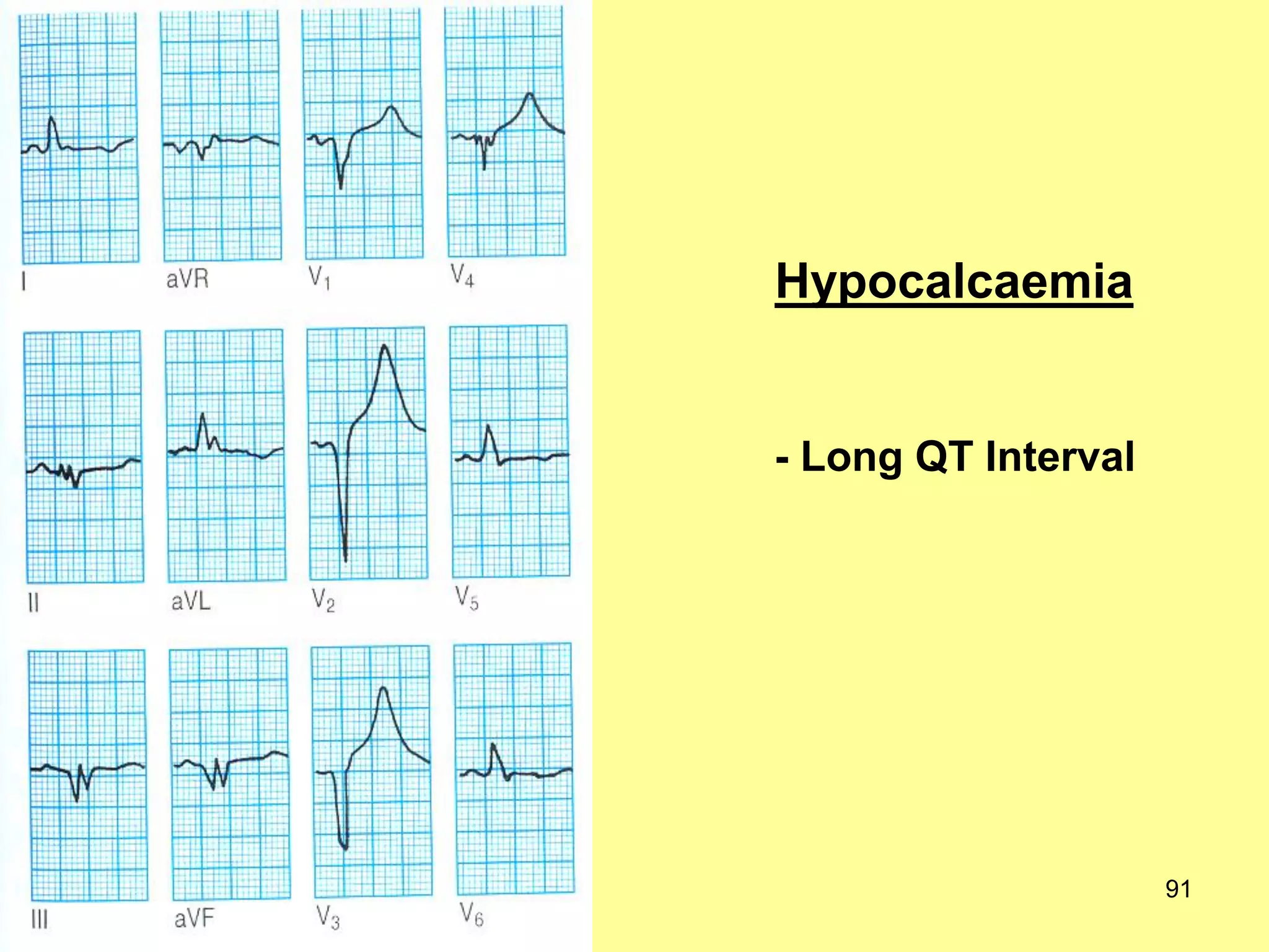 Hypocalcaemia

- Long QT Interval

91

 