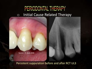 Current approach in periodontal care | PPTX