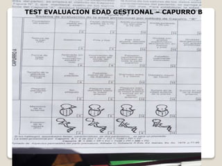 TEST EVALUACION EDAD GESTIONAL – CAPURRO B
 