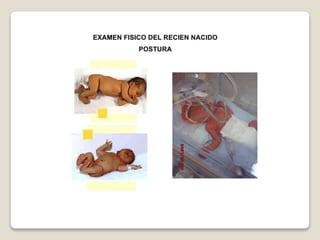 R.n.pretermino final