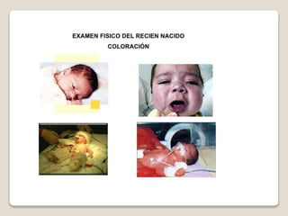 R.n.pretermino final