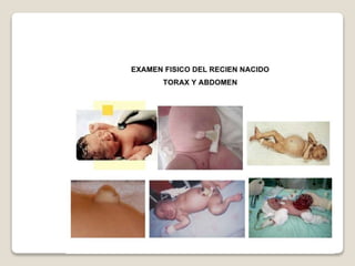 R.n.pretermino final