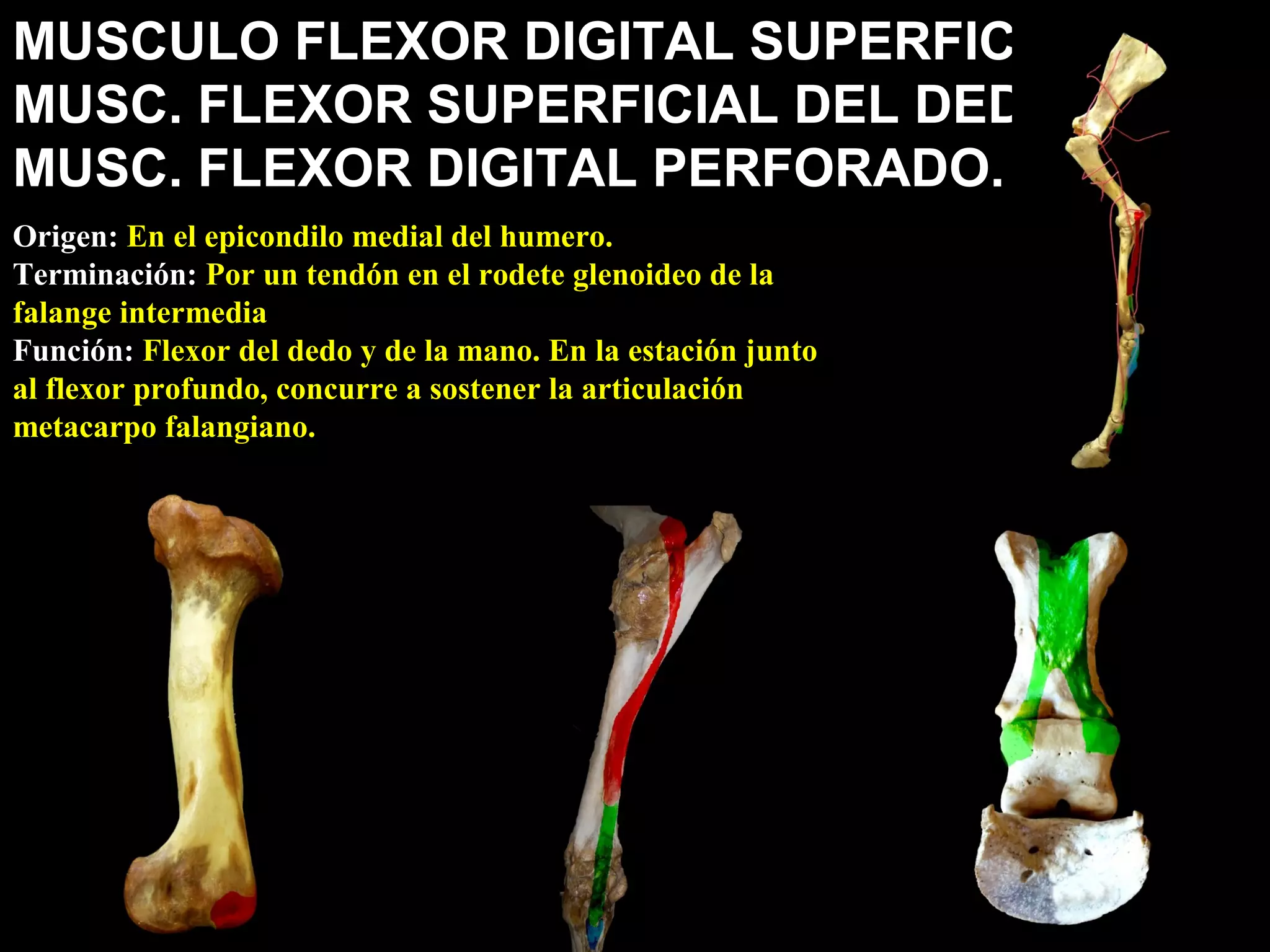 MUSCULO FLEXOR DIGITAL SUPERFICIAL.
MUSC. FLEXOR SUPERFICIAL DEL DEDO.
MUSC. FLEXOR DIGITAL PERFORADO.
Origen: En el epicondilo medial del humero.
Terminación: Por un tendón en el rodete glenoideo de la
falange intermedia
Función: Flexor del dedo y de la mano. En la estación junto
al flexor profundo, concurre a sostener la articulación
metacarpo falangiano.
 
