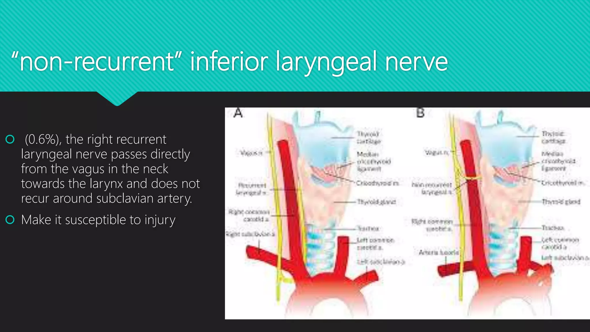 Recurrent laryngeal nerve PPT Recurrent laryngeal nerve PPT