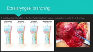 Recurrent laryngeal nerve | PPTX