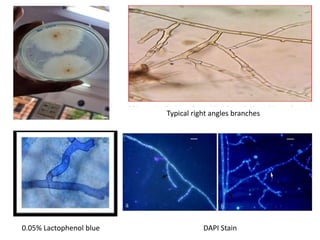 Sheath blight of rice | PPTX