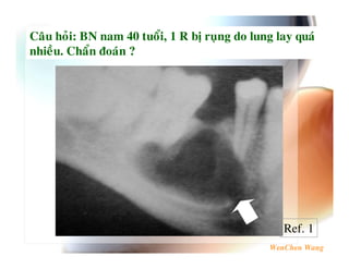 !   . ; G-   $H9   6 ( #E   7
    !         I




                            Ref. 1
 