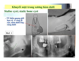 )     7 $ &     '    %$
J K          74 L4   #   74

0
          ,.   %   (
    4   6 M$




    F :8
 