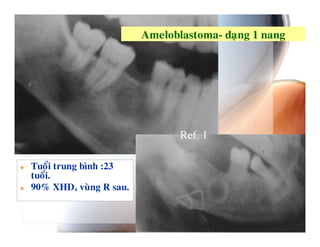 P$   # 4 $ 0




                        Ref. 1

        #3   ; A

B D 52N6 %
 9           (4
 