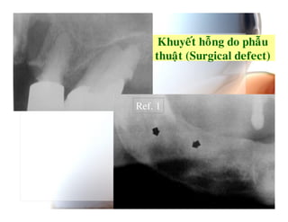 )   7        :   " :
             >J        K ?



Ref. 1
 