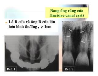-                 .
                    >Y 4            74 ?
 1 ( .   %       ( .
    #3       %   68 $




Ref. 1                     Ref. 2
 