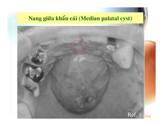 -   ,   >X   "   74 ?




                   Ref. 1
 