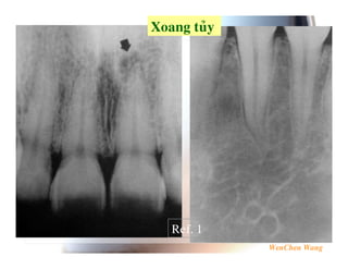 5          .7




    F :8
 