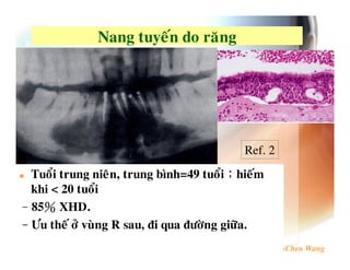 -            7




                                        Ref. 2
                 6        #3   VB
                                H           $
   @ 9
T 52N
 C
_      . %       (4   6             %   ,
 