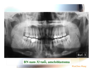 F :E

G-   $A   6$   # 4 $
 