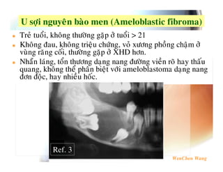 R4       7       # % $     >P$      # 4     K# $ ?
 $'   2             %&      L! &'  2 MB 8
      1              $       %0 ( ' 7%& ! 4        &'
(    $U "        %&       L! &' P 9 &
   V *0   2      %& .                1%& ( 4 $ W 6    "
3                2!      5 (    &0     *5*;   .
1& 1    6         4    "




        Ref. 3
 